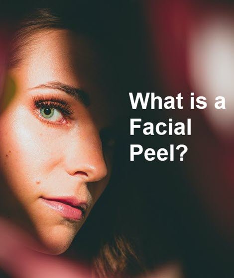 Facial Peel - Cosmetic Peel