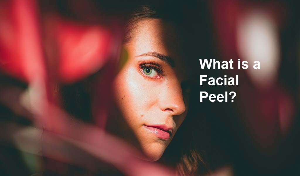 Chemical or Facial Peel – What Is It?